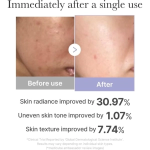 Medicube US AGE R BOOSTER PRO MINI PLUS PINK