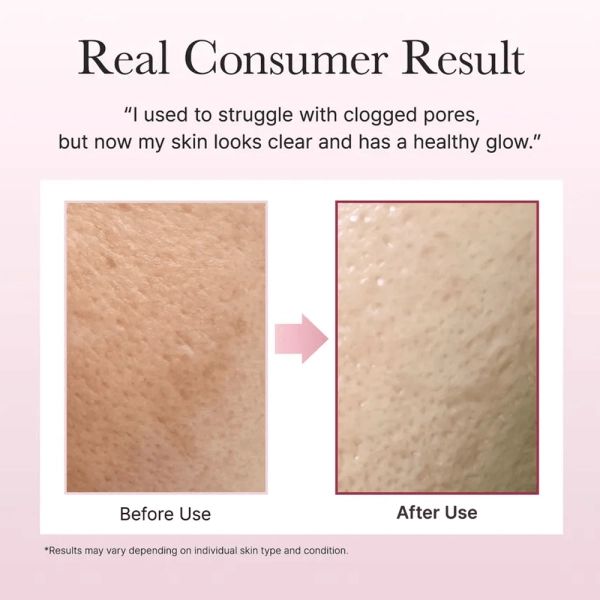 Arencia Fresh Rosehip Rice Mochi Cleanser 120g