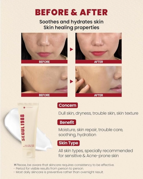 SEOUL 1988 Cream: Snail Mucin 93% + Rice