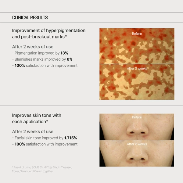 SOME BY MI Yuja Niacin Anti Blemish Cream 60g